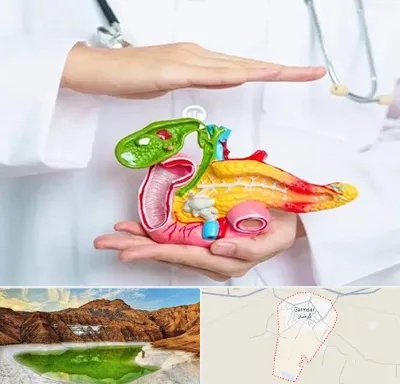 دکتر سرطان لوزالمعده در گرمسار