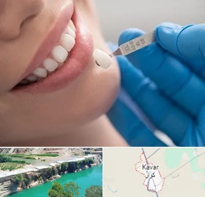 مرکز لمینت دندان در کوار