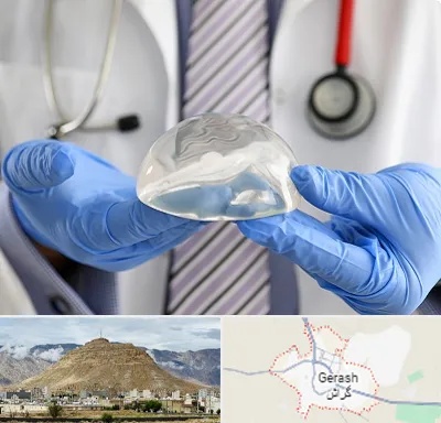 ماموپلاستی در گراش
