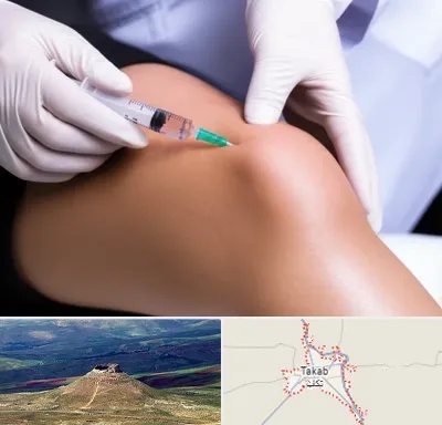پلاسما درمانی PRP در تکاب