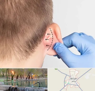 عمل زیبایی گوش در بروجن