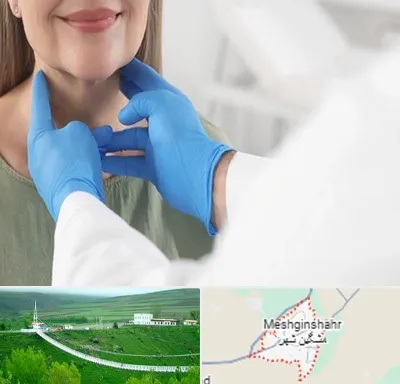 جراح سرطان گلو در مشگین شهر
