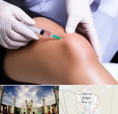 پلاسما درمانی PRP در آران و بیدگل