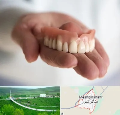 لیفت لثه با لیزر در مشگین شهر