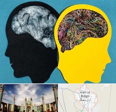دکتر اختلال دوقطبی در آران و بیدگل