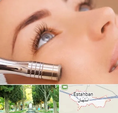 میکرودرم در استهبان