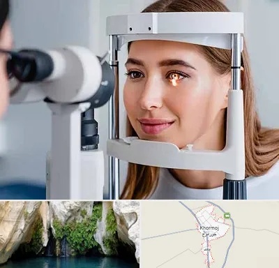 دکتر چشم پزشک خوب در خورموج