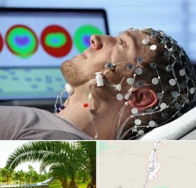 مرکز نوار مغز در کهنوج