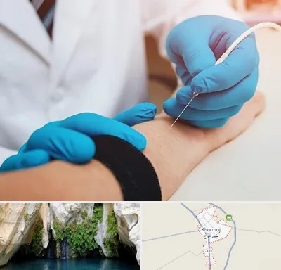 مرکز نوار عصب و عضله در خورموج