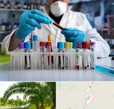 آزمایشگاه خون در کهنوج