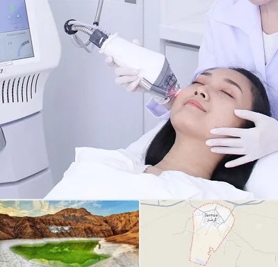 وایتنینگ در گرمسار