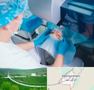 دکتر عمل لازک چشم در مشگین شهر