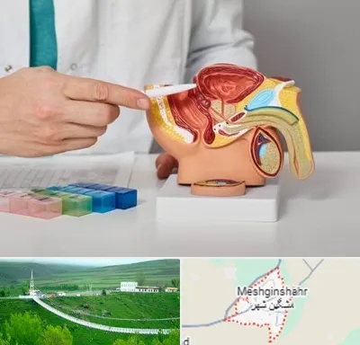 دکتر اورولوژی در مشگین شهر