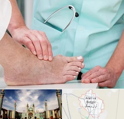 دکتر مفاصل و استخوان در آران و بیدگل