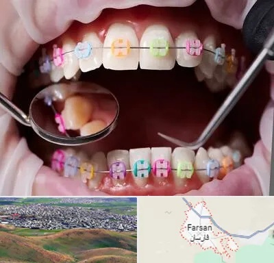 متخصص ارتودنسی در فارسان