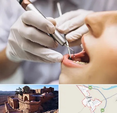 دندانپزشکی ارزان در قائن