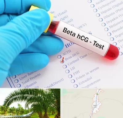 آزمایشگاه بارداری در کهنوج