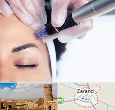 کلینیک مزوتراپی صورت در زرند