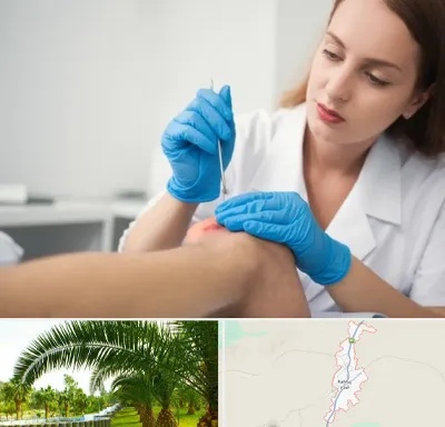 متخصص زخم در کهنوج