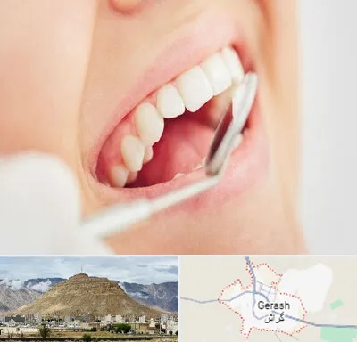 اصلاح طرح لبخند در گراش