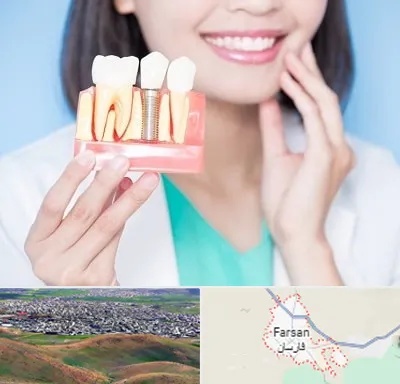 متخصص ایمپلنت در فارسان