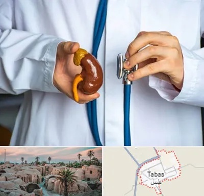 دکتر سرطان کلیه در طبس
