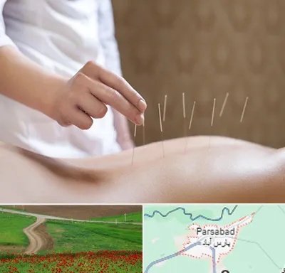 درای نیدلینگ در پارس آباد
