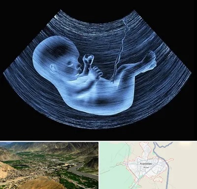 دکتر متخصص غربال گری در اسدآباد