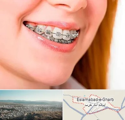 ارتودنسی ارزان در اسلام آباد غرب