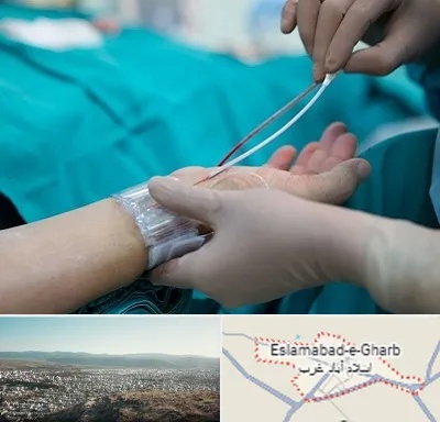 آنژیوگرافی در اسلام آباد غرب