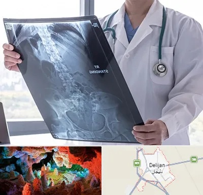رادیولوژی شبانه روزی در دلیجان