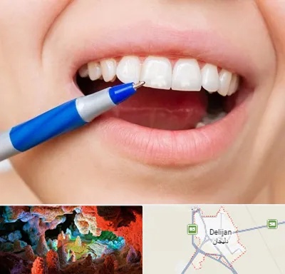 دندانسازی ارزان در دلیجان