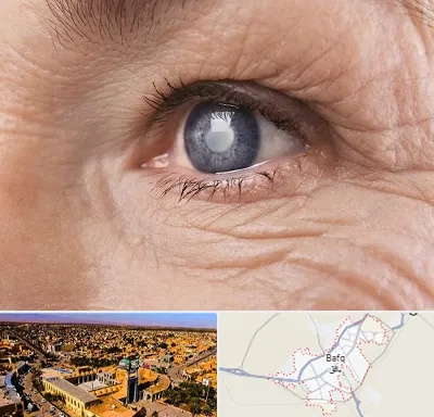 متخصص آب مروارید در بافق