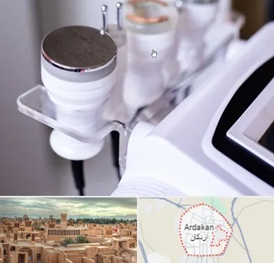 مرکز لاغری با کویتیشن در اردکان