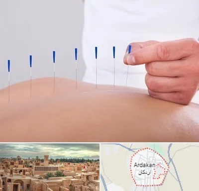 دکتر طب سوزنی در اردکان