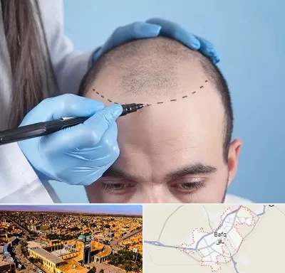 کاشت مو اقساطی در بافق