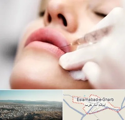 کلینیک تزریق ژل لب در اسلام آباد غرب