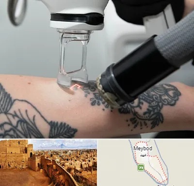ریمو تاتو در میبد