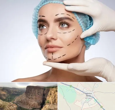 جراحی زیبایی در سرپل ذهاب