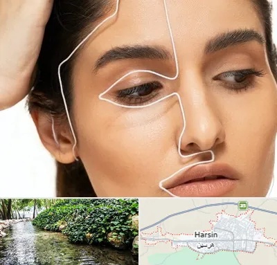 عمل بینی اقساطی در هرسین