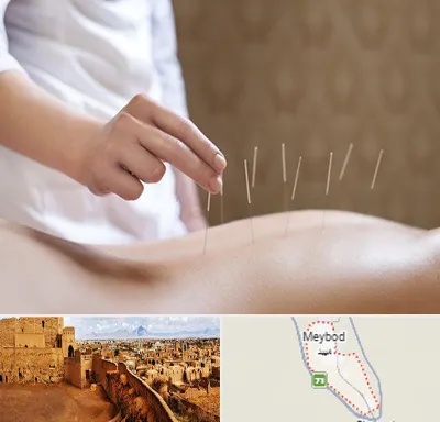 درای نیدلینگ در میبد
