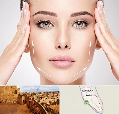 لیفت صورت در میبد