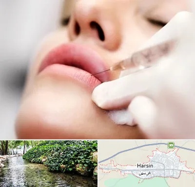 کلینیک تزریق ژل لب در هرسین