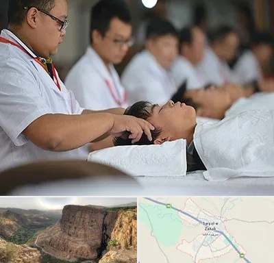 طب چینی در سرپل ذهاب