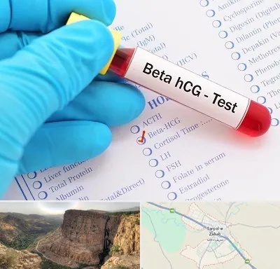 آزمایشگاه بارداری در سرپل ذهاب