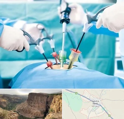 دکتر لاپاراسکوپی در سرپل ذهاب