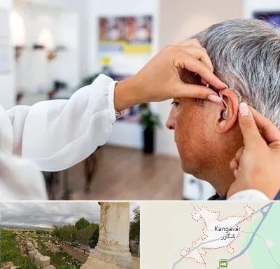 دکتر کم شنوایی در کنگاور