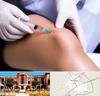 پلاسما درمانی PRP در خمین