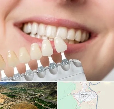 مرکز کامپوزیت دندان در اسدآباد