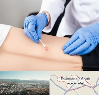 متخصص زخم بستر در اسلام آباد غرب